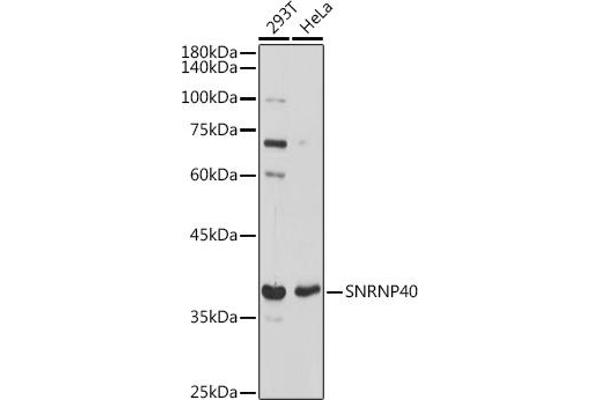 SNRNP40 anticorps
