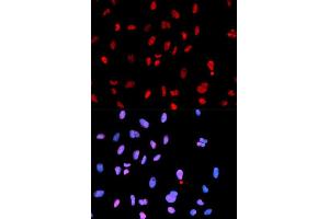 Immunofluorescence analysis of U2OS cells using Phospho-MET-Y1234 antibody (ABIN5969923). (c-MET antibody  (pTyr1234))
