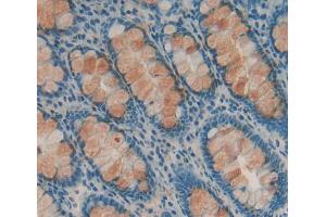 Used in DAB staining on fromalin fixed paraffin- embedded Kidney tissue (DHPS antibody  (AA 1-369))