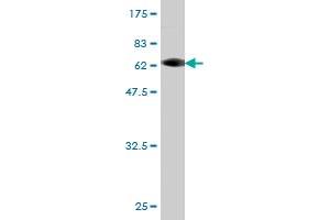 Western Blot detection against Immunogen (62. (CAB39L antibody  (AA 1-337))