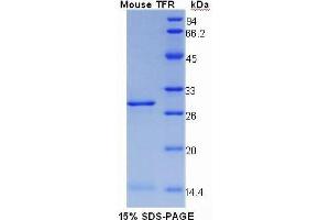 SDS-PAGE (SDS) image for Transferrin Receptor (p90, CD71) (TFRC) (AA 572-757) protein (His tag) (ABIN1099539)