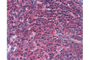Immunohistochemistry (IHC) image for anti-Neuropeptide Y Receptor Y1 (NPY1R) (Middle Region) antibody (ABIN2777014)