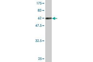 Western Blot detection against Immunogen (63. (RFC5 antibody  (AA 1-340))