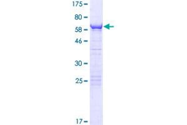 Cwc27 Protein (AA 1-291) (GST tag)