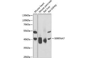 Western blot analysis of extracts of various cell lines, using SERPIN antibody (ABIN6132296, ABIN6147581, ABIN6147582 and ABIN6221920) at 1:1000 dilution. (SERPINA7 antibody  (AA 146-415))