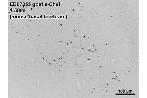 ABIN185635 (0. (Choline Acetyltransferase antibody  (C-Term))