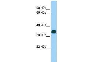 Western Blotting (WB) image for anti-Fibronectin Type III and Ankyrin Repeat Domains 1 (FANK1) (N-Term) antibody (ABIN2784487)