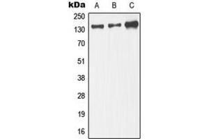 Western blot analysis of JIP3 expression in IMR32 (A), mouse brain. (JIP3 antibody  (Center))