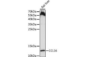 Western blot analysis of extracts of Rat liver, using CCL16 antibody (ABIN7266298) at 1:1000 dilution. (CCL16 antibody  (AA 1-120))