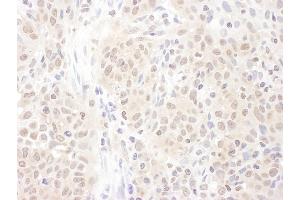 Immunohistochemistry (IHC) image for anti-Proteasome (Prosome, Macropain) Activator Subunit 4 (PSME4) (AA 1-50) antibody (ABIN7454980)