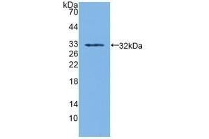 Detection of Recombinant SDH, Human using Polyclonal Antibody to Sorbitol Dehydrogenase (SDH) (SORD antibody  (AA 98-355))