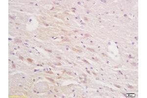Formalin-fixed and paraffin embedded rat brain tissue labeled with Anti-Squalene EpoxidasePolyclonal Antibody, Unconjugated (ABIN705401) at 1:200 followed by conjugation to the secondary antibody and DAB staining (SQLE antibody  (AA 101-200))