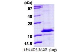 HD Domain Containing 3 (HDDC3) (AA 1-140) protein (His tag)