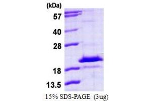SDS-PAGE (SDS) image for HD Domain Containing 3 (HDDC3) (AA 1-140) protein (His tag) (ABIN667594)