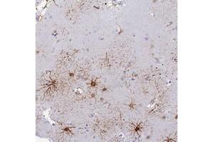 Immunohistochemical staining of human lateral ventricle with ASUN polyclonal antibody  shows distinct positivity in astrocytes and neuropil at 1:200-1:500 dilution. (C12orf11 antibody)