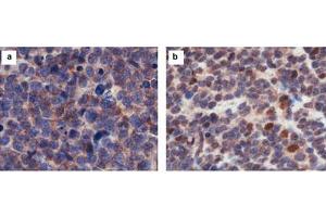 Immunohistochemistry (IHC) image for anti-Castor Zinc Finger 1 (CASZ1) (Internal Region) antibody (ABIN964598)
