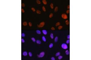 Immunofluorescence (IF) image for anti-SWI/SNF Related, Matrix Associated, Actin Dependent Regulator of Chromatin, Subfamily A, Member 5 (SMARCA5) antibody (ABIN7270656)