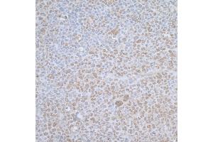 Immunohistochemistry (IHC) image for anti-Transcription Elongation Factor B (SIII), Polypeptide 1 (15kDa, Elongin C) (TCEB1) (AA 1-50) antibody (ABIN7453544)