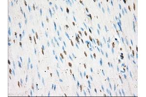 Immunohistochemical staining of paraffin-embedded colon tissue using anti-BSG mouse monoclonal antibody. (CD147 antibody)