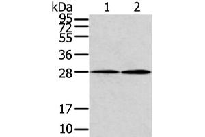 Western Blot analysis of Mouse heart and lung tissue using KCNMB1 Polyclonal Antibody at dilution of 1/500 (KCNMB1 antibody)