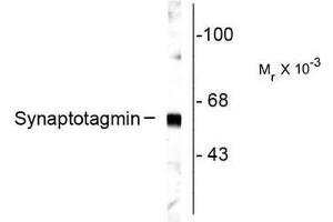 Image no. 1 for anti-Synaptotagmin I (SYT1) antibody (ABIN372723) (SYT1 antibody)