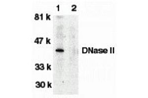Western Blotting (WB) image for anti-Deoxyribonuclease II, Lysosomal (DNASE2) antibody (ABIN1031743)