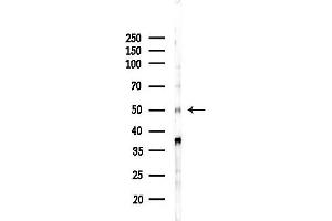 anti-Forkhead Box N3 (FOXN3) antibody