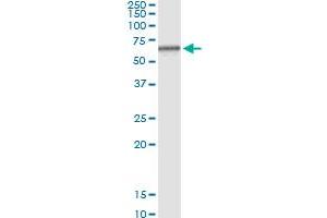 Immunoprecipitation of RAG2 transfected lysate using anti-RAG2 MaxPab rabbit polyclonal antibody and Protein A Magnetic Bead , and immunoblotted with RAG2 purified MaxPab mouse polyclonal antibody (B01P) . (RAG2 antibody  (AA 1-527))