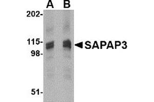 Western Blotting (WB) image for anti-Discs, Large (Drosophila) Homolog-Associated Protein 3 (DLGAP3) (C-Term) antibody (ABIN1030637) (DLGAP3 antibody  (C-Term))