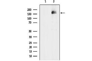 anti-ATP-Binding Cassette, Sub-Family C (CFTR/MRP), Member 10 (ABCC10) (C-Term) antibody