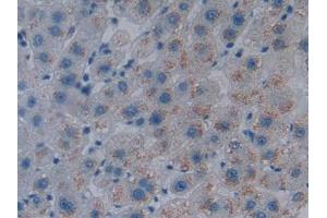 Figure DAB staining on IHC-P Samples: Human Liver Tissue (HMOX1 antibody  (AA 61-172))