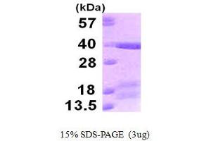 SDS-PAGE (SDS) image for Toll-Like Receptor Adaptor Molecule 2 (TICAM2) (AA 1-235) protein (His tag) (ABIN667668)