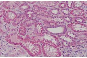 Human Kidney: Formalin-Fixed, Paraffin-Embedded (FFPE) (GSTM1 antibody  (AA 1-159))