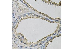 Immunohistochemistry of paraffin-embedded human prostate using LCN1 antibody at dilution of 1:100 (x40 lens). (Lipocalin 1 antibody)