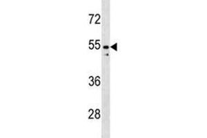 PAX2 antibody western blot analysis in K562 lysate (PAX2A antibody  (AA 187-216))