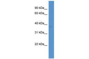 Image no. 1 for anti-5'-Nucleotidase, Cytosolic IA (NT5C1A) (AA 227-276) antibody (ABIN6746811) (NT5C1A antibody  (AA 227-276))