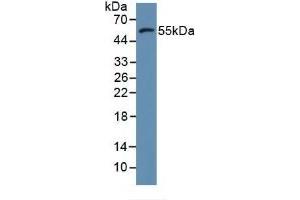 Detection of MMP11 in Human MCF7 Cells using Polyclonal Antibody to Matrix Metalloproteinase 11 (MMP11) (MMP11 antibody  (AA 287-491))