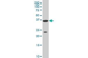 DLX3 monoclonal antibody (M02), clone 3B8 Western Blot analysis of DLX3 expression in A-549 . (DLX3 antibody  (AA 1-287))