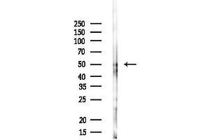 anti-Suppressor of Cytokine Signaling 4 (SOCS4) antibody