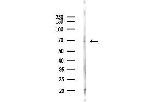 anti-Calcium/calmodulin-Dependent Protein Kinase Kinase 2, beta (CAMKK2) (C-Term) antibody