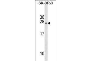 Western blot analysis in SK-BR-3 cell line lysates (35ug/lane). (TUSC5 antibody  (AA 78-104))