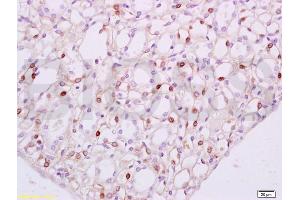 Formalin-fixed and paraffin embedded rat kidney tissue labeled with Anti-Cathepsin G Polyclonal Antibody, Unconjugated (ABIN731843) at 1:100 followed by conjugation to the secondary antibody, (SP-0023), and DAB staining (Cathepsin G antibody  (AA 41-120))