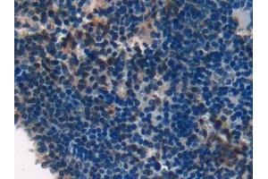 Detection of LAMA1 in Mouse Spleen Tissue using Polyclonal Antibody to Laminin Alpha 1 (LAMA1) (Laminin alpha 1 antibody  (AA 2640-2773))