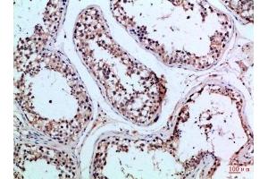 Immunohistochemical analysis of paraffin-embedded Human-testis, antibody was diluted at 1:100. (PIK3R2 antibody  (AA 1-60))