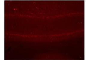 Immunohistochemistry with cerebellum tissue (SGCE antibody  (N-Term))