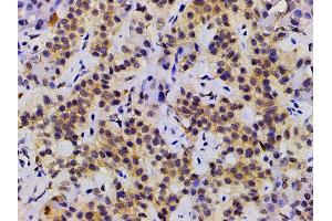Immunohistochemistry (IHC) image for anti-Ephrin B2 (EFNB2) (C-Term) antibody (ABIN6261455)