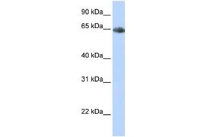 Western Blotting (WB) image for anti-Solute Carrier Family 6 (Neurotransmitter Transporter, Noradrenalin), Member 2 (SLC6A2) antibody (ABIN2458614)