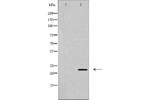 Western blot analysis of CLDN6 expression in Jurkat cells,The lane on the left is treated with the antigen-specific peptide. (Claudin 6 antibody  (Internal Region))