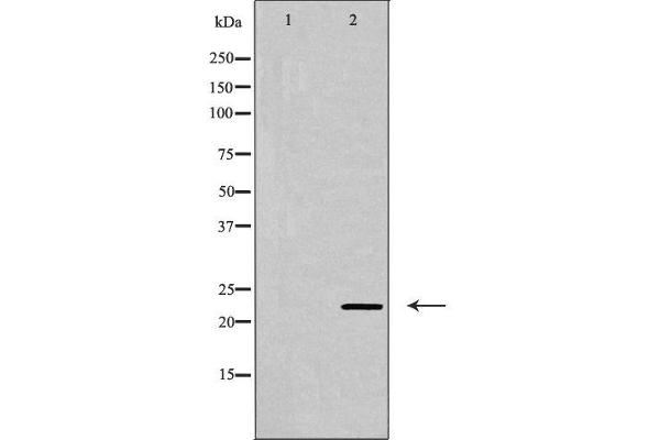 Claudin 6 antibody  (Internal Region)