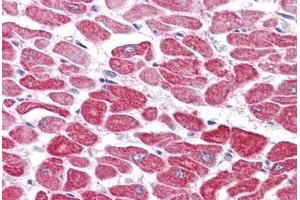 Human Heart: Formalin-Fixed, Paraffin-Embedded (FFPE) (RSPO1 antibody  (N-Term))
